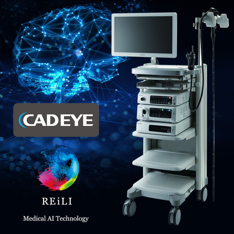 AI内視鏡診断支援システム「CAD EYE」